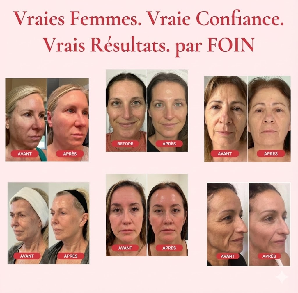 Foin™ Crème Madeca Soin Anti-Âge Absolu